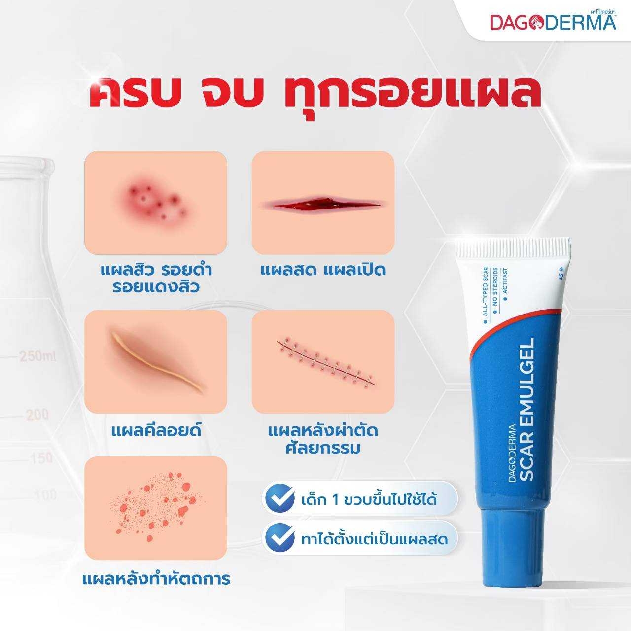 Dagokids Dagoderma Scar Emulgel ครีมลดรอยแผลเป็น รอยแดง รอยดำ 15 g.