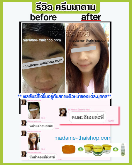 เซทหน้าขาวใส ไร้ริ้วรอย ลดความหมองคล้ำ เซท 5 กรัม มาดาม ออแกนิค