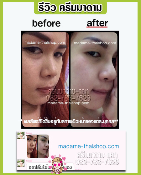 เซทหน้าขาวใส ไร้ริ้วรอย ลดความหมองคล้ำ เซท 5 กรัม มาดาม ออแกนิค