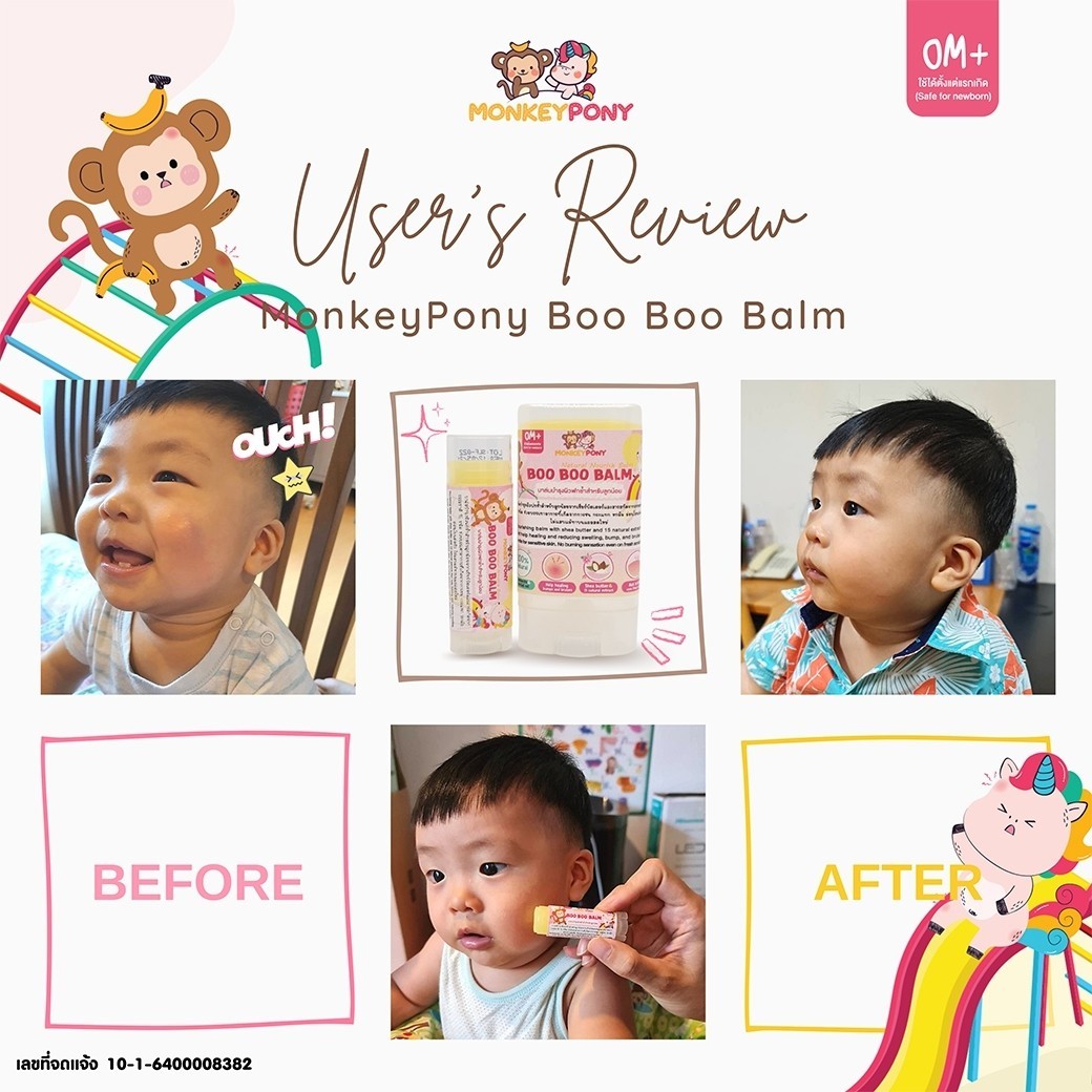 MonkeyPony บาล์มลดบวม ฟกช้ำ ดำเขียว จากการกระแทก หกล้ม