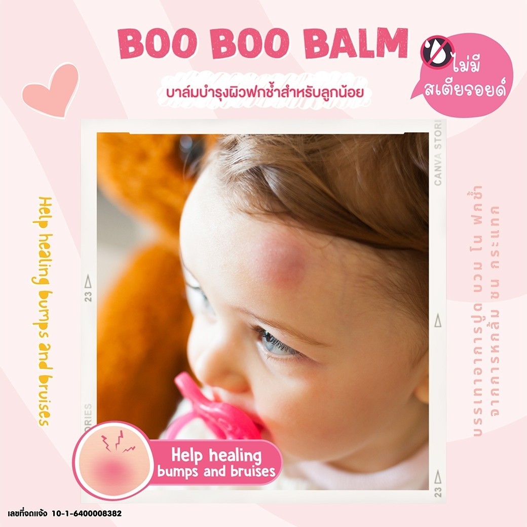 MonkeyPony บาล์มลดบวม ฟกช้ำ ดำเขียว จากการกระแทก หกล้ม