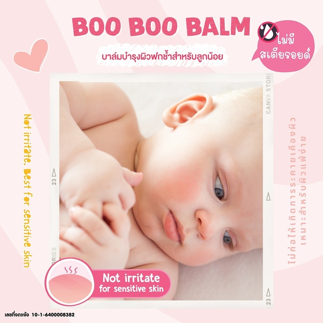 MonkeyPony บาล์มลดบวม ฟกช้ำ ดำเขียว จากการกระแทก หกล้ม