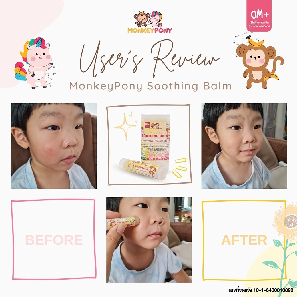 MonkeyPony บาล์มแก้คัน ลดบวม ลดรอยดำ ลดรอยแดง หลังยุงและแมลงกัด สามารถใช้ได้ตั้งแต่เด็กแรกเกิด