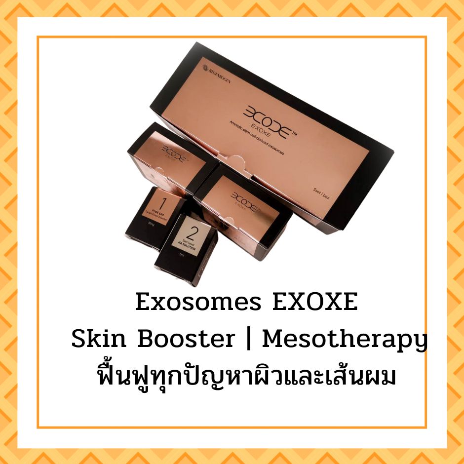 EXOXE