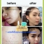 เซทสิวยุบ ผิวมัน ผดผื่น เซท 15 กรัม มาดาม ออแกนิค
